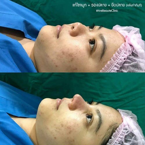 before after_240325_1 before after_240325_1