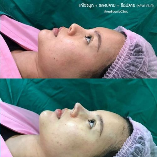 before after_240325_13 before after_240325_13